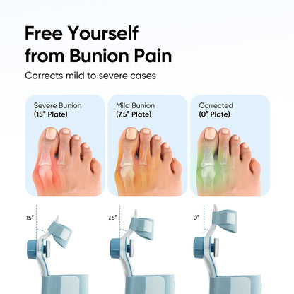 ComfortStep Daily Active Bunion Corrector