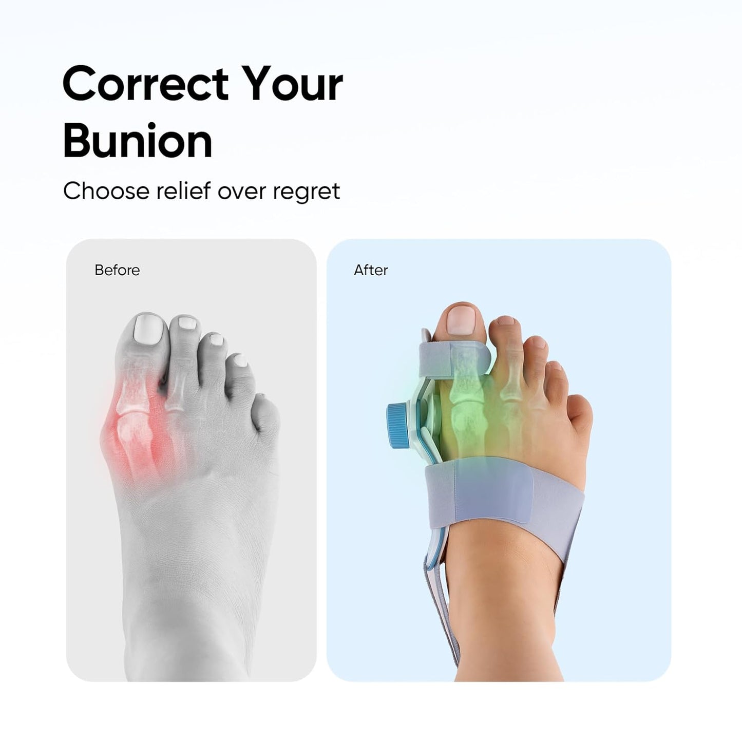 ComfortStep Daily Active Bunion Corrector